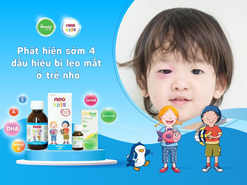 Phát hiện sớm 4 dấu hiệu bị lẹo mắt ở trẻ nhỏ